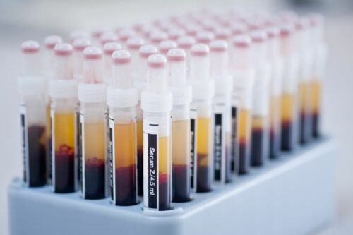 Analyses plasmatiques