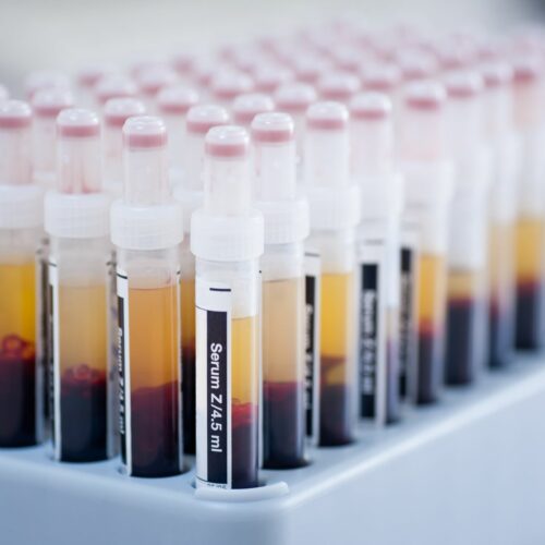 Analyses plasmatiques